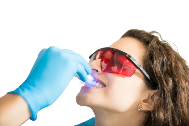 Blanqueamiento Dental